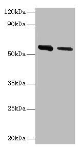 ADSL antibody