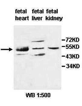 ADSL Rabbit Polyclonal Antibody