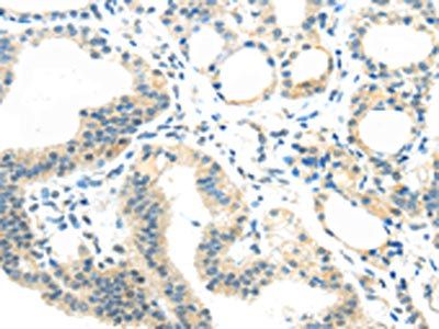 AEBP1 Antibody