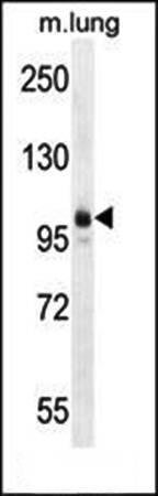 AEBP1 antibody