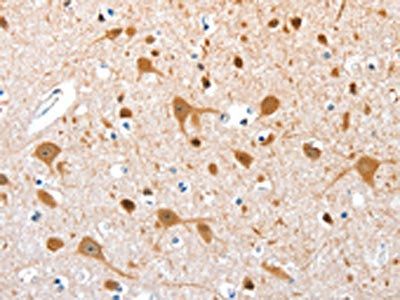 AEBP2 Antibody