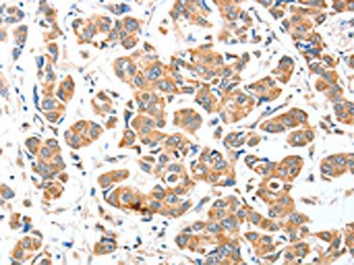 AEBP2 antibody