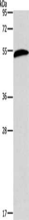 AEBP2 Antibody