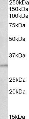 AES Antibody