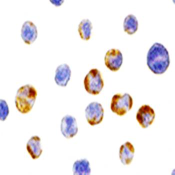 AES Antibody