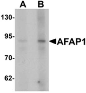 AFAP1 Rabbit Polyclonal Antibody