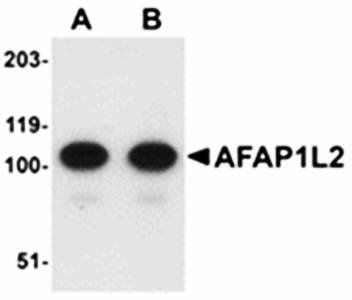 AFAP1L2 Antibody