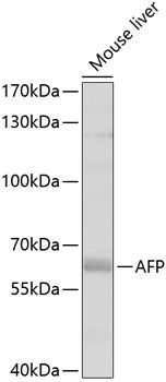 AFP antibody
