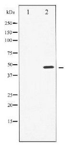 AFP Antibody