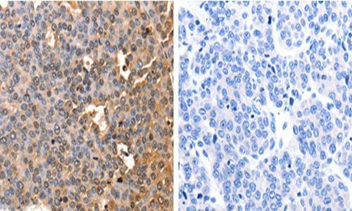 AFP Antibody