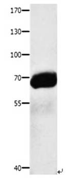AFP Antibody