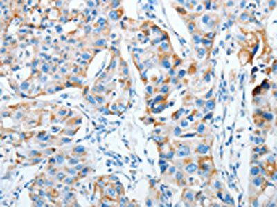 AGA Antibody