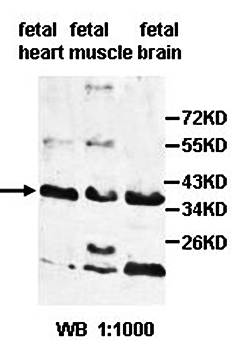 AGA antibody