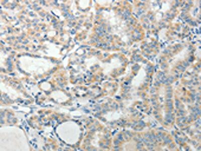 AGAP1 Antibody