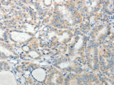 AGAP1 antibody