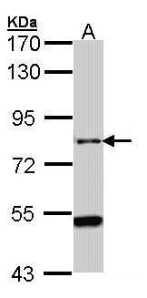 AGAP1 antibody [C3], C-term