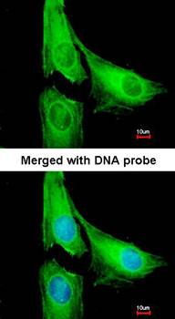 AGAP1 antibody