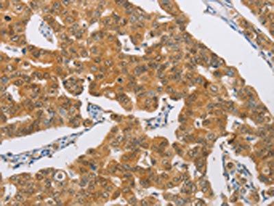 AGAP2 Antibody