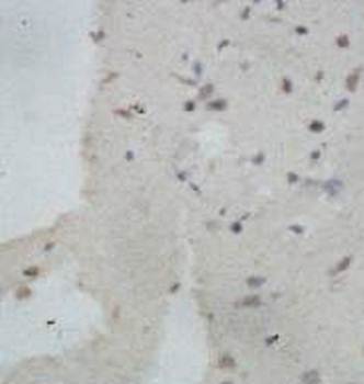 AGAP2 Rabbit Polyclonal Antibody