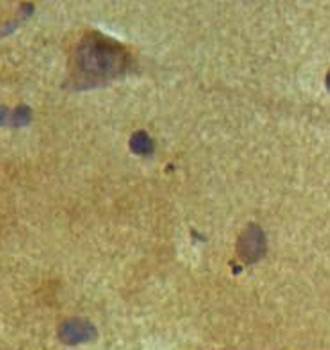 AGAP Rabbit Polyclonal Antibody