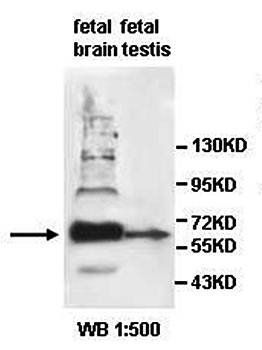 AGAP Rabbit Polyclonal Antibody