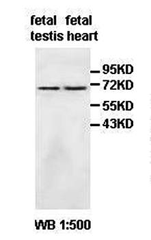 AGAP Rabbit Polyclonal Antibody