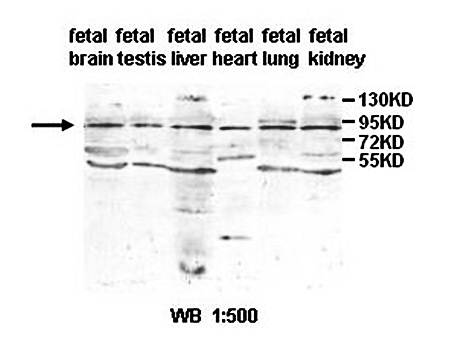 AGAP Rabbit Polyclonal Antibody