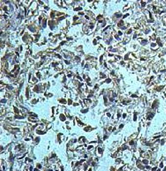 AGAP Rabbit Polyclonal Antibody