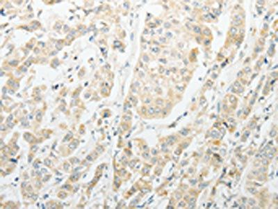 AGBL1 Antibody