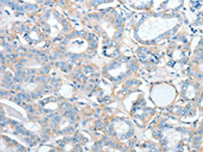 AGBL2 antibody