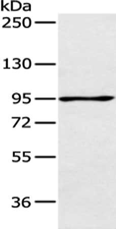 AGBL2 antibody