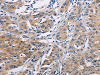 AGBL5 antibody