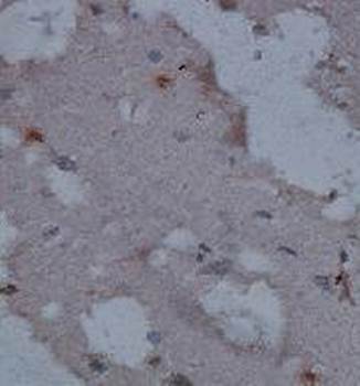 AGBL5 Rabbit Polyclonal Antibody