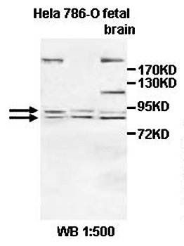 AGBL5 Rabbit Polyclonal Antibody