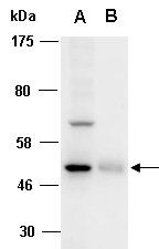 AGER (N) Antibody, Rabbit Polyclonal