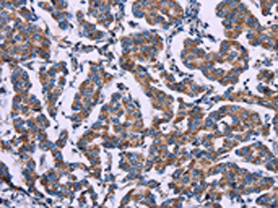 AGFG1 Antibody