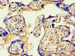 AGGF1 Antibody