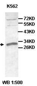 AGPAT1 antibody