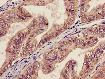 AGPAT5 Antibody