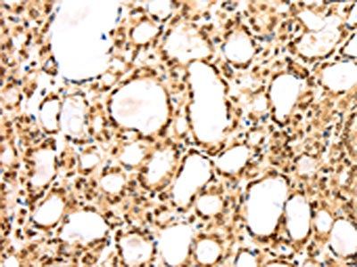 AGPAT9 Antibody