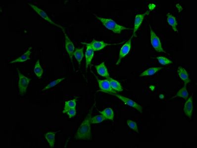 AGPS Antibody