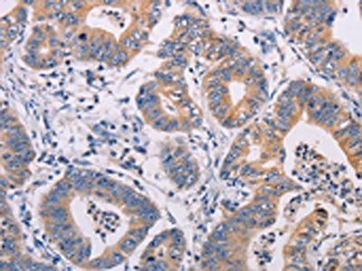 AGPS Antibody