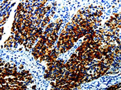AGR2 Antibody