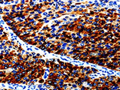 AGR2 Antibody