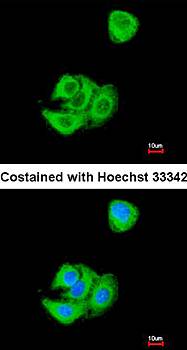 Breast cancer membrane protein 11 precursor antibody