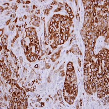 Breast cancer membrane protein 11 precursor antibody