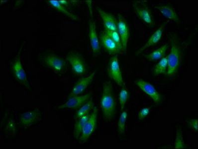 AGRN Antibody
