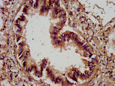 AGRN Antibody