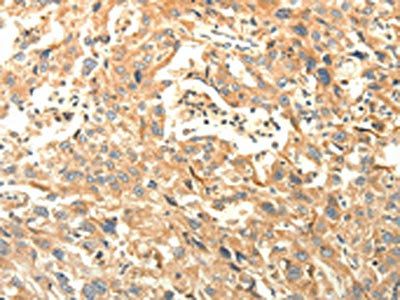 AGRN Antibody
