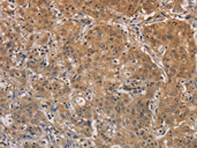 AGTRAP Antibody